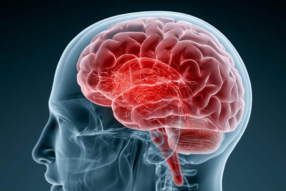 Concussions Convert Brain Stabilizers Into Disruptive Forces